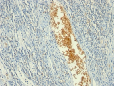 Formalin-fixed, paraffin-embedded human Placenta stained with AMPD3 Monoclonal Antibody (AMPD3/91)