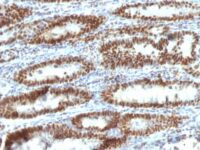 Formalin-fixed, paraffin-embedded human Gall Bladder stained with TOX3 Monoclonal Antibody (TOX3/1123).