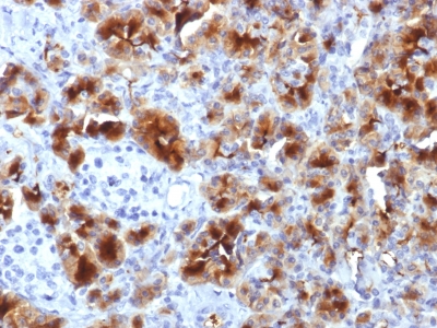 Formalin-fixed, paraffin-embedded human Pancreas stained with GP2 Monoclonal Antibody (GP2/1712).