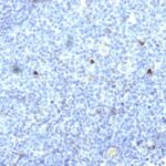 Formalin-fixed, paraffin-embedded human Tonsil stained with MHC I Monoclonal Antibody (SPM418).