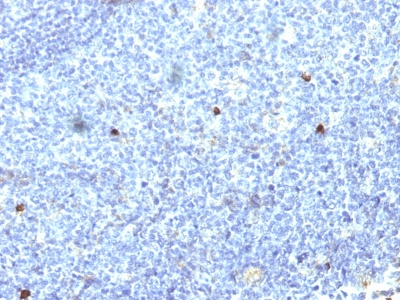 Formalin-fixed, paraffin-embedded human Tonsil stained with MHC I Monoclonal Antibody (SPM418).
