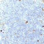 Formalin-fixed, paraffin-embedded human Tonsil stained with MHC I Monoclonal Antibody (SPM417).