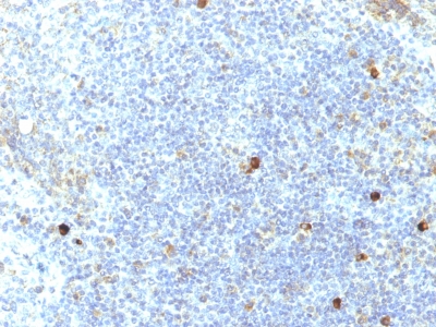 Formalin-fixed, paraffin-embedded human Tonsil stained with MHC I Monoclonal Antibody (SPM417).