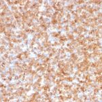 Formalin-fixed, paraffin-embedded human Tonsil stained with HLA-DP/-DQ/-DR Monoclonal Antibody (CR3/43).