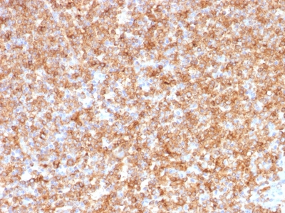 Formalin-fixed, paraffin-embedded human Tonsil stained with HLA-DP/-DQ/-DR Monoclonal Antibody (CR3/43).