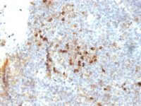 Formalin-fixed, paraffin-embedded human Tonsil stained with HLA-DRA Monoclonal Antibody (19-26.1).