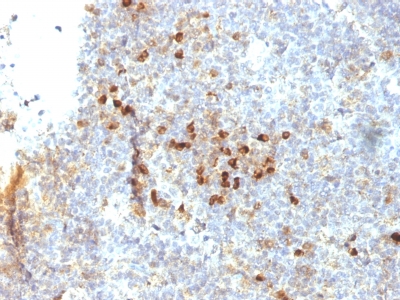 Formalin-fixed, paraffin-embedded human Tonsil stained with HLA-DRA Monoclonal Antibody (19-26.1).
