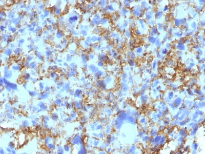 Formalin-fixed, paraffin-embedded human Tonsil stained with HLA-DRB Monoclonal Antibody (LN-3).