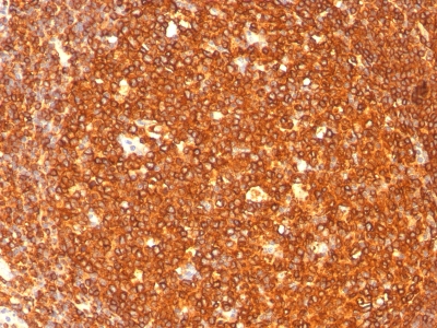 Formalin-fixed, paraffin-embedded human Tonsil stained with HLA-DRB Monoclonal Antibody (SPM289).