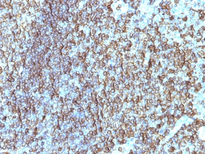 Formalin-fixed, paraffin-embedded human Tonsil stained with HLA-DRB Monoclonal Antibody (SPM288).