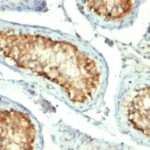 Formalin-fixed, paraffin-embedded human Tonsil stained with HSP6 Monoclonal Antibody (GROEL/73)