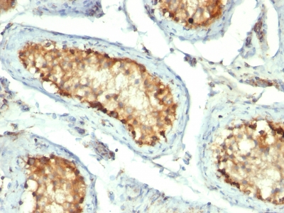Formalin-fixed, paraffin-embedded human Tonsil stained with HSP6 Monoclonal Antibody (GROEL/73)