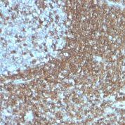 Formalin-fixed, paraffin-embedded human Tonsil stained with CD5 Monoclonal Antibody (186-2G9)