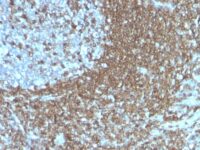 Formalin-fixed, paraffin-embedded human Tonsil stained with CD5 Monoclonal Antibody (186-2G9)