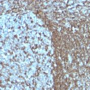Formalin-fixed, paraffin-embedded human Tonsil stained with CD5 Monoclonal Antibody (SPM55)