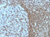 Formalin-fixed, paraffin-embedded human Tonsil stained with CD5 Monoclonal Antibody (SPM55)