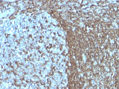 Formalin-fixed, paraffin-embedded human Tonsil stained with CD5 Monoclonal Antibody (SPM55)