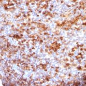 Formalin-fixed, paraffin-embedded human Tonsil stained with IgG Monoclonal Antibody (B33/2)