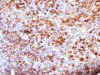 Formalin-fixed, paraffin-embedded human Tonsil stained with IgG Monoclonal Antibody (B33/2)