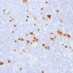 Formalin-fixed, paraffin-embedded human Tonsil stained with Anti-human IgG Recombinant Rabbit Monoclonal Antibody (IG57R)