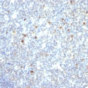 Western Blot Analysis of Raji Cell Lysate using IgM Monoclonal Antibody (IM26)