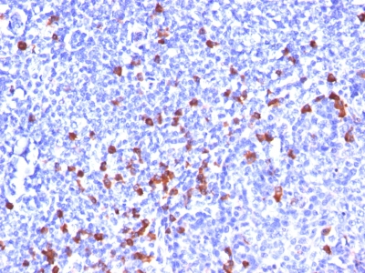 Formalin-fixed, paraffin-embedded human Tonsil stained with Kappa Light Chain Monoclonal Antibody (SPM58).
