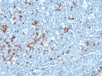 Western Blot Analysis of Raji Cell Lysate using Kappa Light Chain Monoclonal Antibody (HP653 + L1C1).