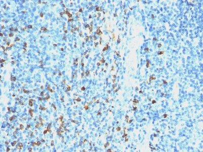 Western Blot of human Intestinal Lysate using Lambda Light Chain Ab (SPM559).