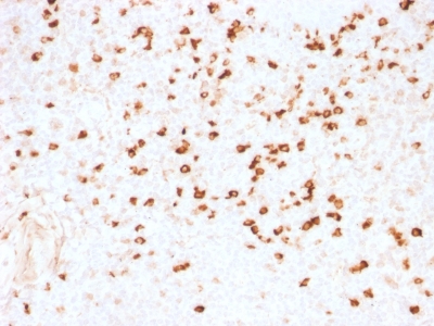 Formalin-fixed, paraffin-embedded human Tonsil stained with Lambda Light Chain Monoclonal Antibody (N1/2).