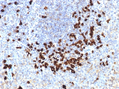 Formalin-fixed, paraffin-embedded human Tonsil stained with Lambda Light Chain Monoclonal Antibody (LLC/1738).