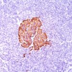 Formalin-fixed, paraffin-embedded human Pancreas stained with Insulin Monoclonal Antibody (SPM139).