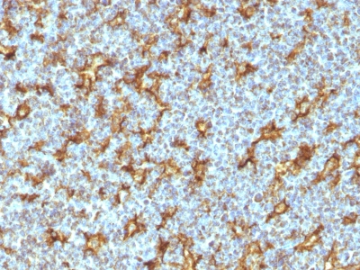 Formalin-fixed, paraffin-embedded human Tonsil stained with CD11c Monoclonal Antibody (ITGAX/1242) at 1ug/ml. Antigen retrieval in 1mM Tris with 1mM EDTA, pH 9.; ABC detection system with DAB Chromogen. Note staining of dendritic cells.