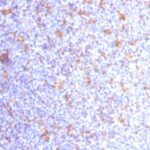 Formalin-fixed, paraffin-embedded human Tonsil stained with CD11c Monoclonal Antibody (ITGAX/1284).