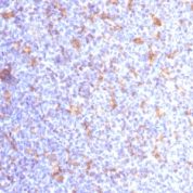 Formalin-fixed, paraffin-embedded human Tonsil stained with CD11c Monoclonal Antibody (ITGAX/1284).