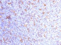 Formalin-fixed, paraffin-embedded human Tonsil stained with CD11c Monoclonal Antibody (ITGAX/1284).