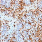 Formalin-fixed, paraffin-embedded human Spleen stained with CD61 Monoclonal Antibody (Y2/51).