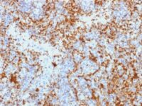 Formalin-fixed, paraffin-embedded human Spleen stained with CD61 Monoclonal Antibody (Y2/51).