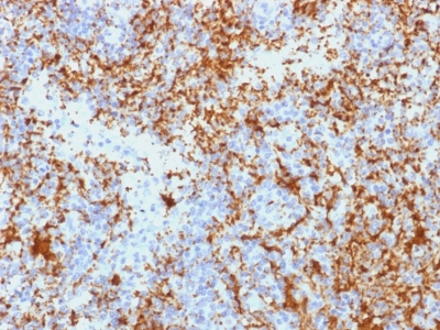 Formalin-fixed, paraffin-embedded human Spleen stained with CD61 Monoclonal Antibody (Y2/51).