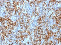 Formalin-fixed, paraffin-embedded human Spleen stained with CD61 Monoclonal Antibody (ITGB3/1713).