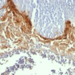 Formalin-fixed, paraffin-embedded human Tonsil stained with Involucrin Monoclonal Antibody (SY5)