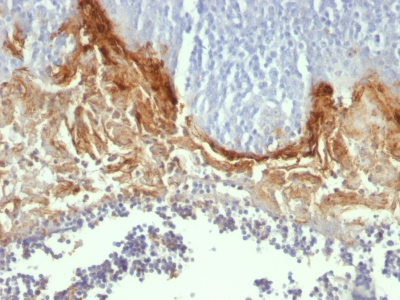 Formalin-fixed, paraffin-embedded human Tonsil stained with Involucrin Monoclonal Antibody (SY5)