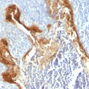 Formalin-fixed, paraffin-embedded human Tonsil stained with Involucrin Monoclonal Antibody (IVRN/827)