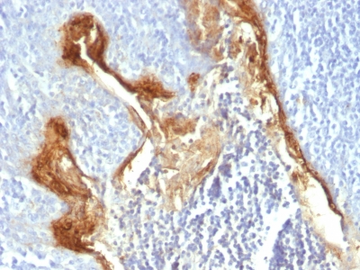 Formalin-fixed, paraffin-embedded human Tonsil stained with Involucrin Monoclonal Antibody (IVRN/827)
