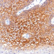Formalin-fixed, paraffin-embedded human Skin stained with Catenin, gamma Monoclonal Antibody (CTNG/1483)