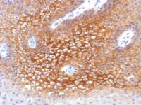 Formalin-fixed, paraffin-embedded human Skin stained with Catenin, gamma Monoclonal Antibody (CTNG/1483)