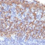 Formalin-fixed, paraffin-embedded prostate stained with Cytokeratin 14 Monoclonal Antibody (LL2).