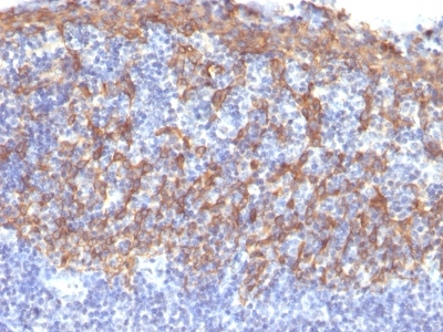 Formalin-fixed, paraffin-embedded prostate stained with Cytokeratin 14 Monoclonal Antibody (LL2).