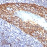 Formalin-fixed, paraffin-embedded human Cervix stained with Cytokeratin 14 Monoclonal Antibody (KRT14/532).