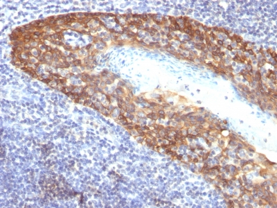 Formalin-fixed, paraffin-embedded human Cervix stained with Cytokeratin 14 Monoclonal Antibody (KRT14/532).