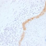 Formalin-fixed, paraffin-embedded human Skin Stained with Cytokeratin 15 Monoclonal Antibody (LHK15).
